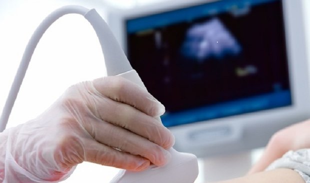 کدام بیماریهای جنین با سونوگرافی قابل تشخیص است؟